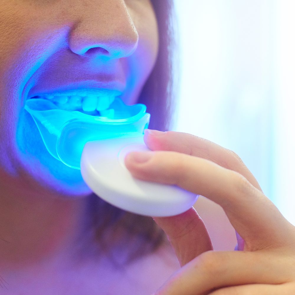 Verabschieden Sie sich von verfärbten Zähnen und begrüßen Sie ein strahlend weißes Lächeln. Entdecken Sie die Vorteile von Home Bleaching und vertrauen Sie auf unsere hochwertigen Produkte für ein perfektes Ergebnis.