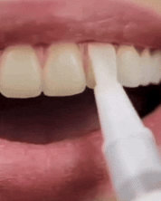 Whitening Pen