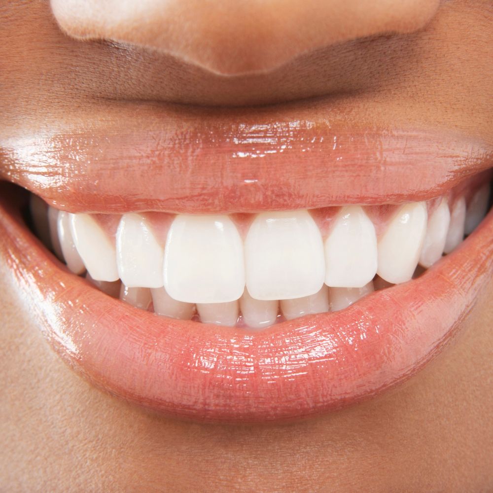 Verabschieden Sie sich von verfärbten Zähnen und begrüßen Sie ein strahlend weißes Lächeln. Entdecken Sie die Vorteile von Home Bleaching und vertrauen Sie auf unsere hochwertigen Produkte für ein perfektes Ergebnis.