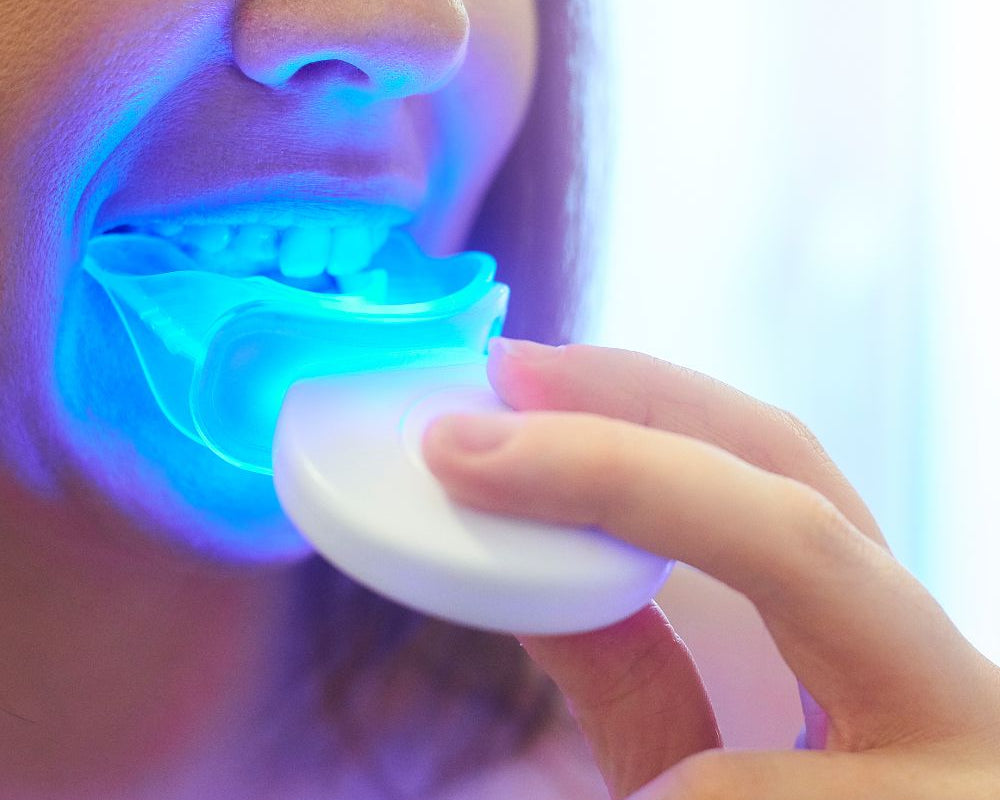 Verabschieden Sie sich von verfärbten Zähnen und begrüßen Sie ein strahlend weißes Lächeln. Entdecken Sie die Vorteile von Home Bleaching und vertrauen Sie auf unsere hochwertigen Produkte für ein perfektes Ergebnis.