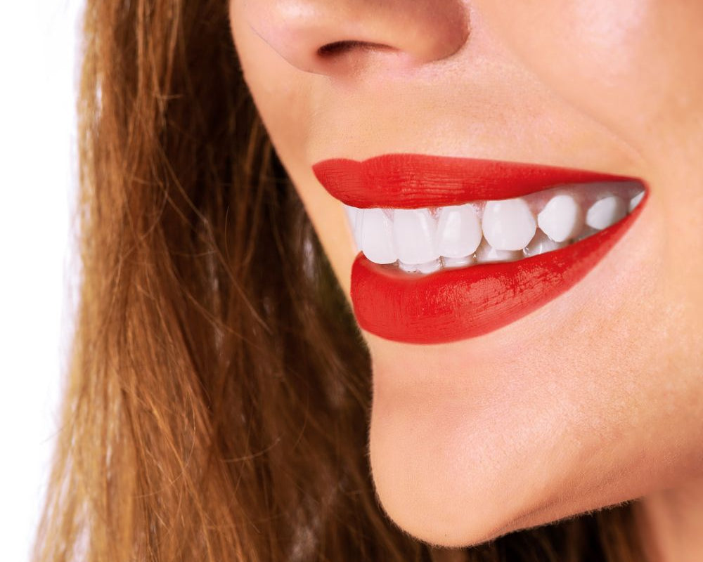 Zahnbleaching für empfindliche Zähne: Tipps und Tricks für ein strahlendes Lächeln ohne Schmerzen